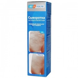 Сыворотка До и после антицеллюлитная 130 мл